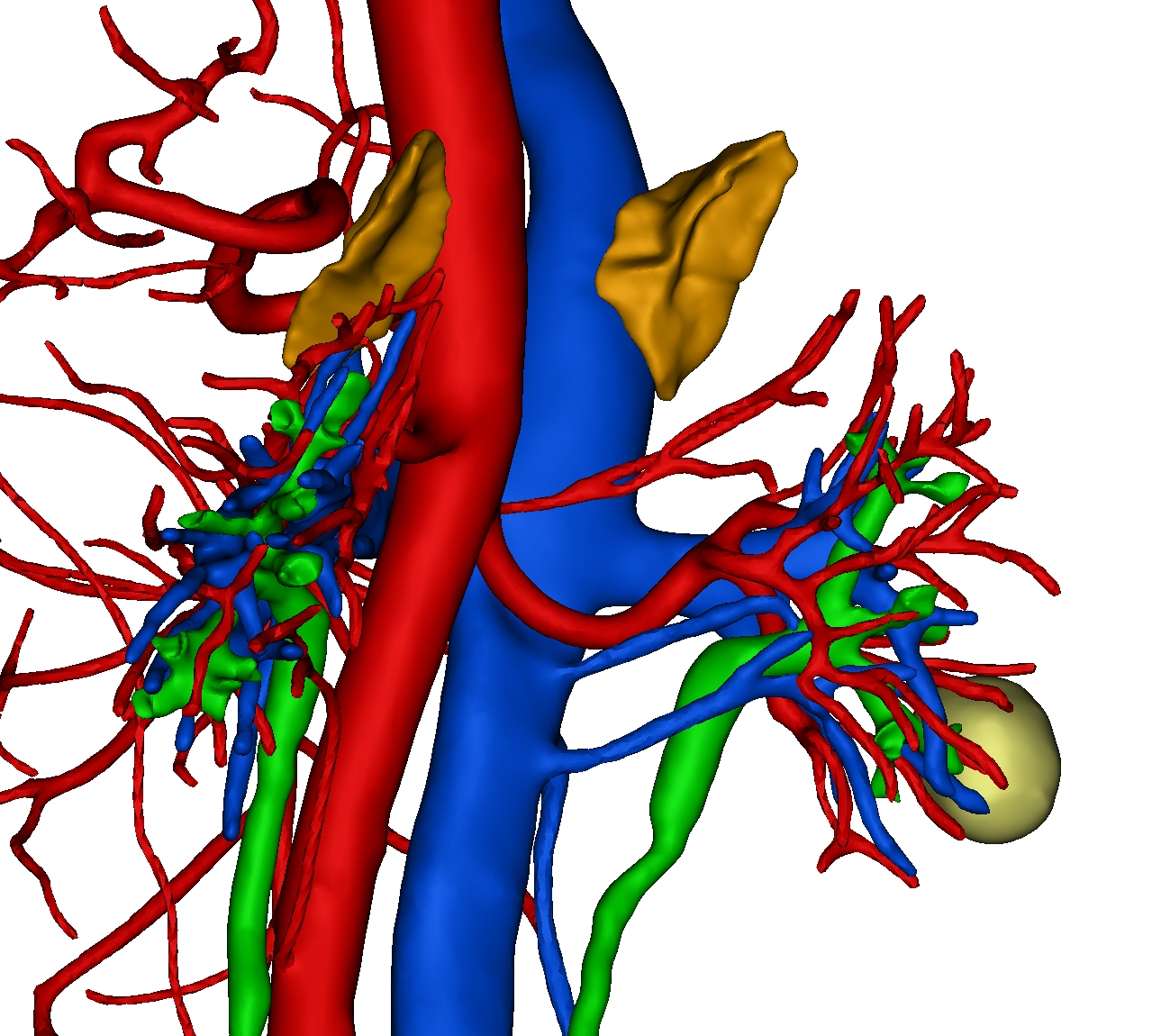 泌尿系三維重建3D打印模型