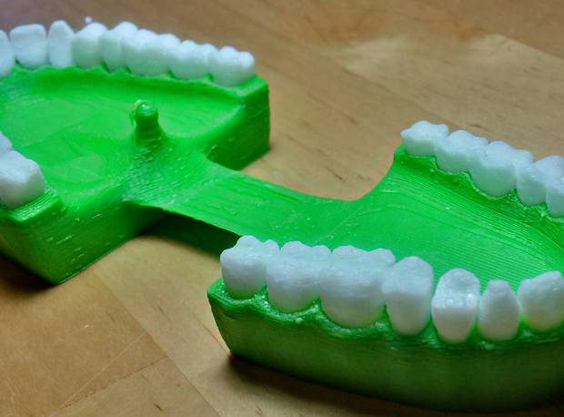 牙齒3D打印模型