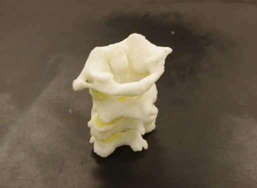 人類頸椎3D打印模型