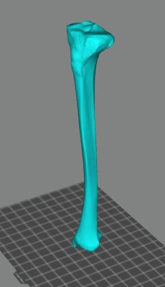 人的左腿脛骨3D打印模型