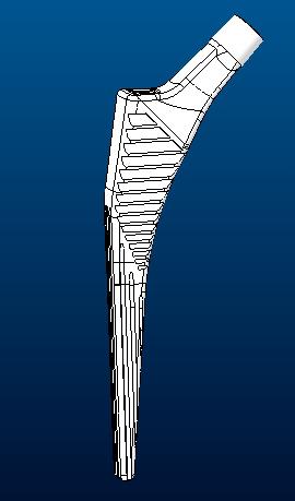 髖關(guān)節(jié)假體的股骨柄coral3D打印模型