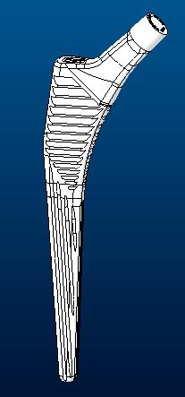 髖關(guān)節(jié)假體的股骨柄coral3D打印模型